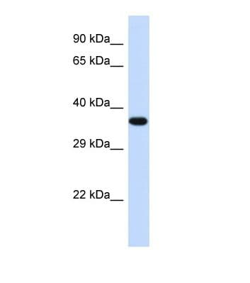 TOB2 Antibody (aa41-90)
