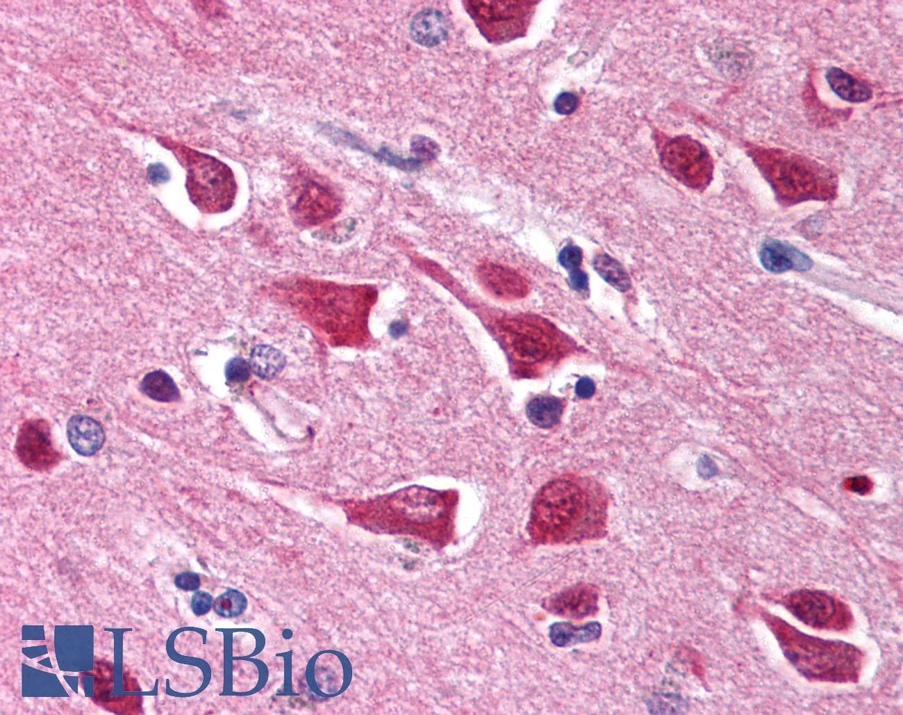 GRM6 / MGLUR6 Antibody (aa700-749)