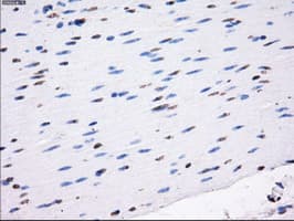 Monoclonal Mouse anti-Human LOX / Lysyl Oxidase Antibody (clone OTI5C4, IHC, IF, WB)