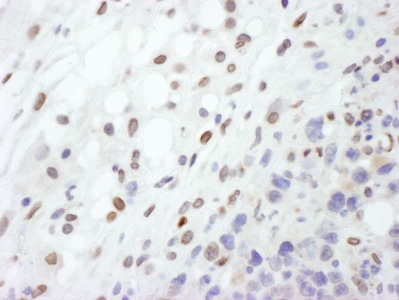 LMNA / Lamin A+C Antibody (aa400-450)