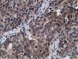 Monoclonal Mouse anti-Human Gephyrin Antibody (clone OTI3B6, IHC, IF, WB)