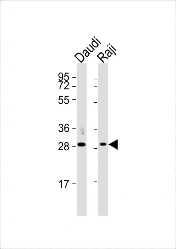 HLA-DQA1 Antibody (aa58-90)