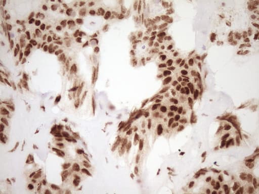 NUDT21 Antibody (aa2-227, clone OTI5B3)
