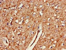 GAB2 Antibody