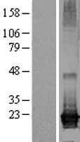 ARL8A Protein (Over-Expression Lysate Myc-DDK (Flag))