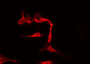Polyclonal Rabbit anti-Human GRK7 / GPRK7 Antibody (IF, WB)