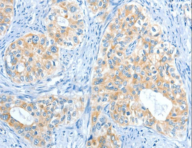 COL4A2 / Collagen IV Alpha2 Antibody