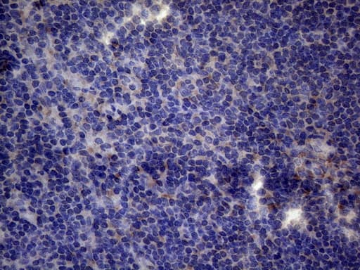 TNFRSF10B / Killer / DR5 Antibody (aa203-411, clone OTI5G5)