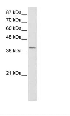 Polyclonal Rabbit anti-Human LMX1A Antibody (FITC, aa244-293, IHC, WB)