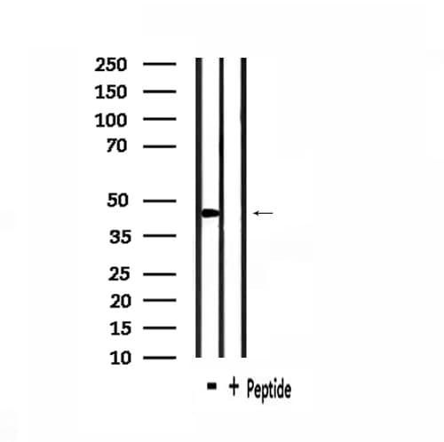 UBE1DC1 / UBA5 Antibody