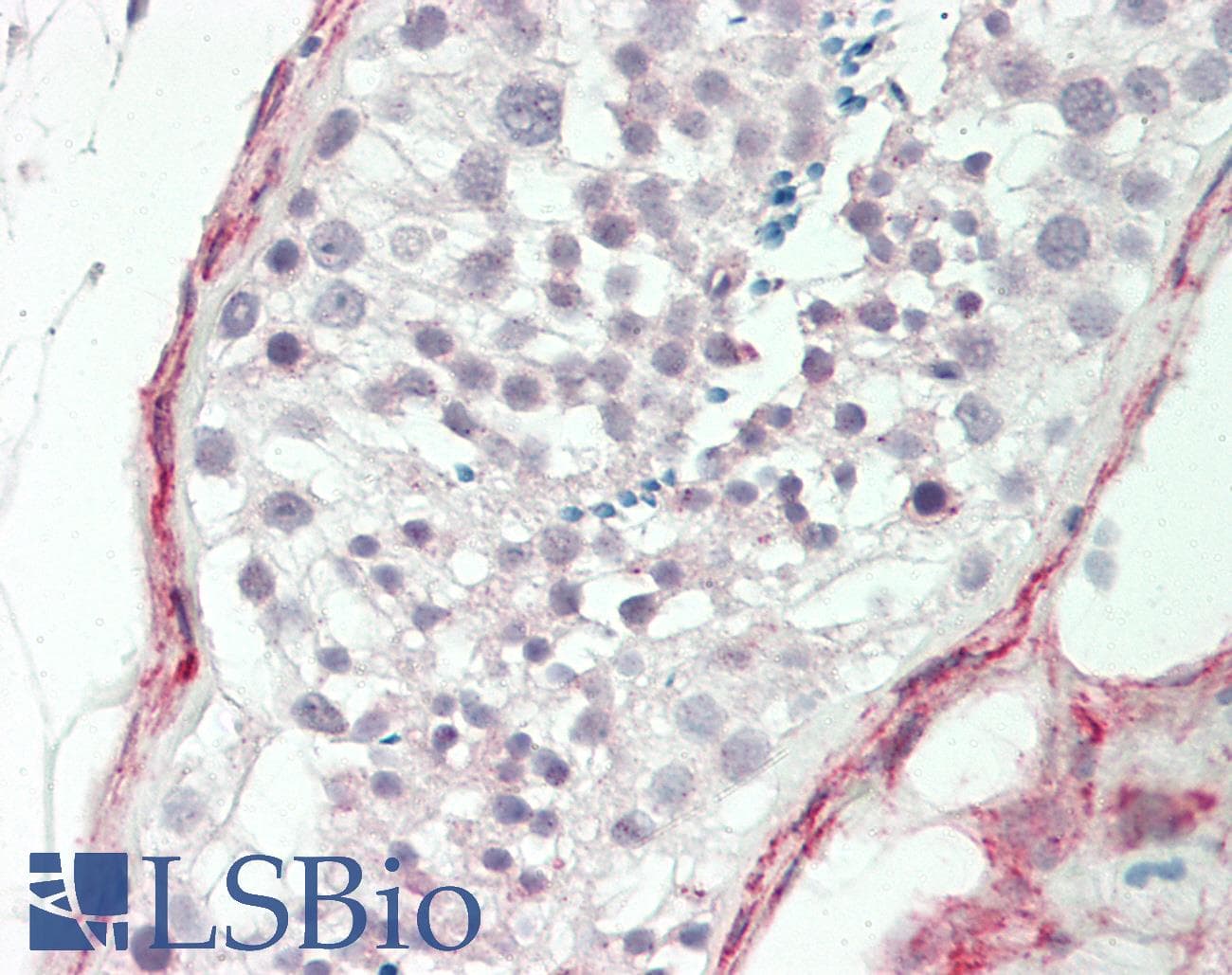 IHC-plus™ Polyclonal Rabbit anti-Human CDC42BPB / MRCKB Antibody (Phe1665, IHC, WB)