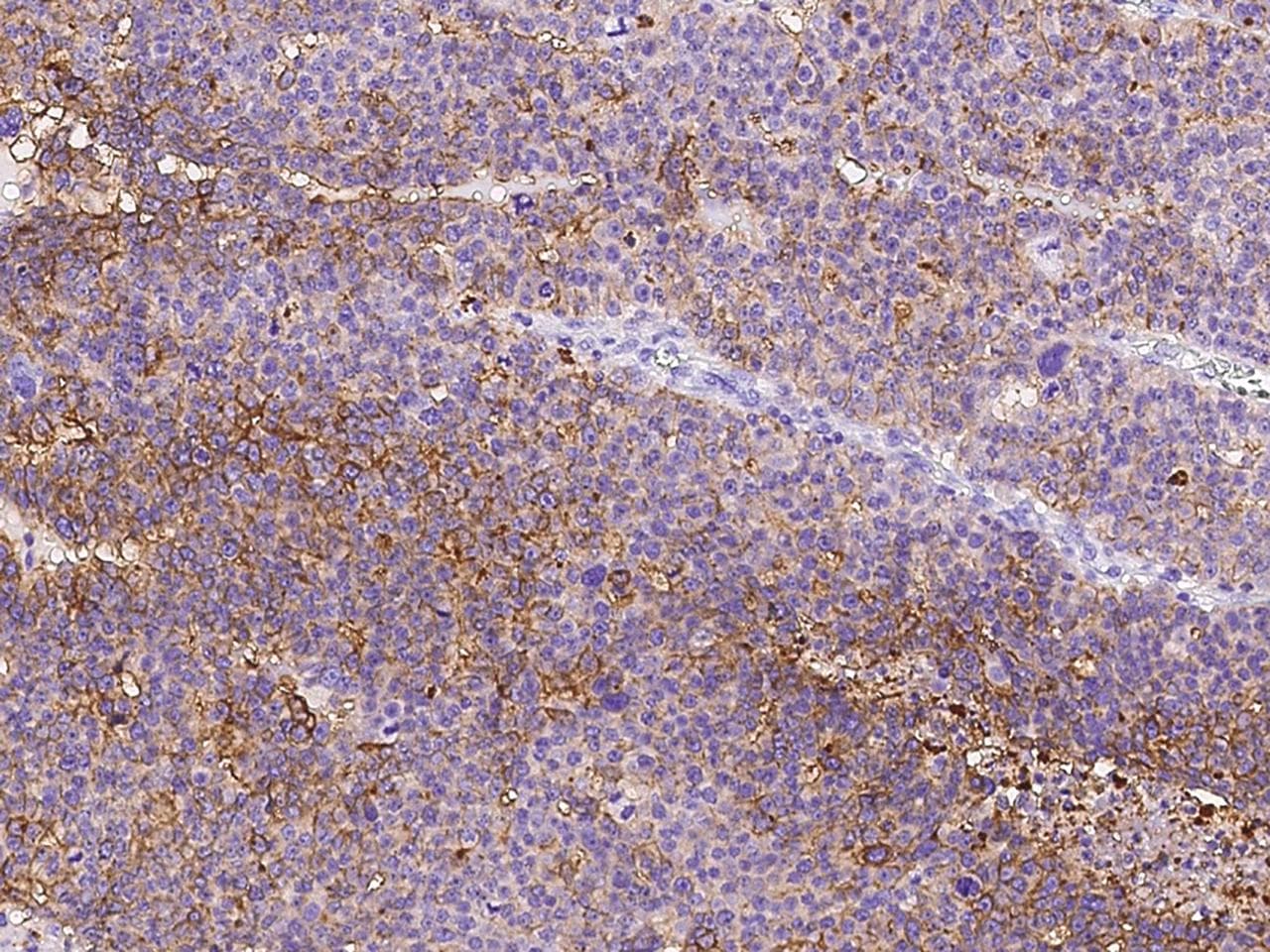 Polyclonal Rabbit anti-Human CD47 Antibody (IHC, IF)