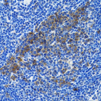 Polyclonal Rabbit anti-Human HSPH1 / HSP105 Antibody (IHC, WB)