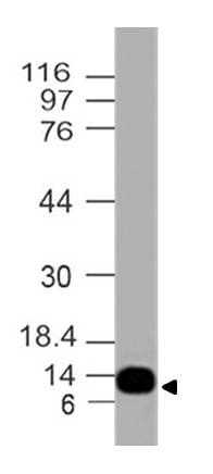 S100A4 / FSP1 Antibody