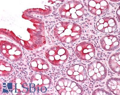 IHC-plus™ PICK1 Antibody (aa100-110)