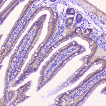 CDH3 / P-Cadherin Antibody