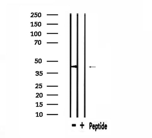 PHLDA1 Antibody
