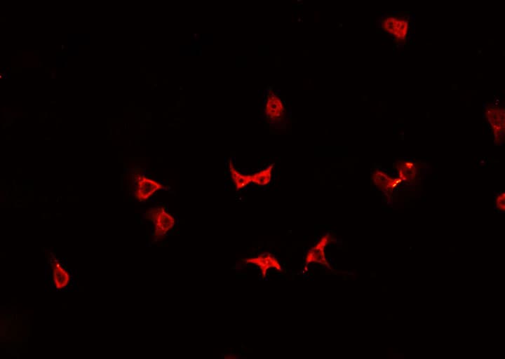 HSPH1 / HSP105 Antibody