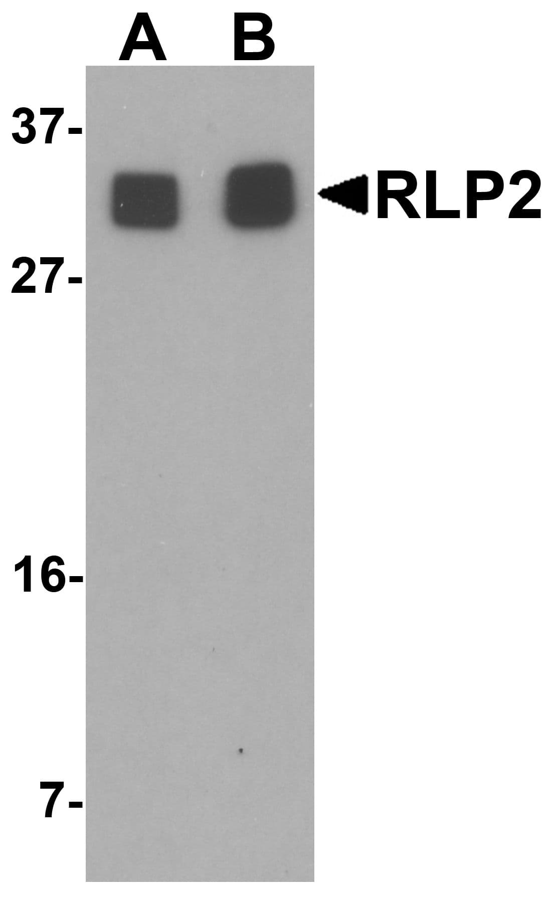 IHC-plus™ Polyclonal Rabbit anti-Human RILPL2 Antibody (IHC, IF, WB)