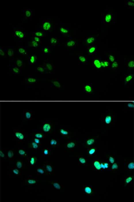HNF4A / HNF4 Antibody