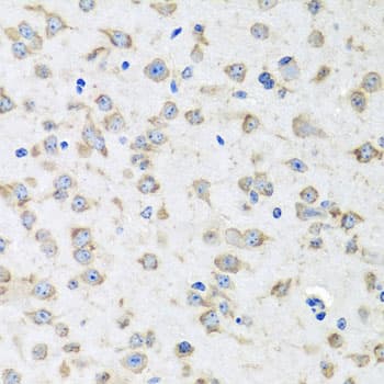 Polyclonal Rabbit anti-Human RPLP1 Antibody (IHC, IF, WB)