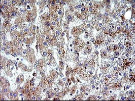 NFKBIA / IKB Alpha / IKBA Antibody (clone OTI2F5)