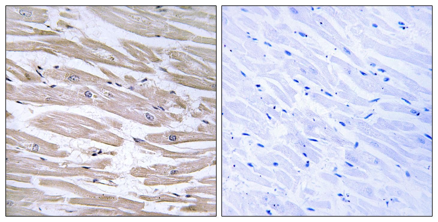 DNAJB11 Antibody