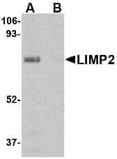 IHC-plus™ Polyclonal Rabbit anti-Human LIMPII / SCARB2 Antibody (IHC, IF, WB)