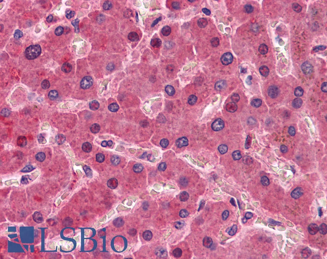 IHC-plus™ F12 / Factor XII Antibody