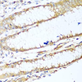 Polyclonal Rabbit anti-Human MYH9 Antibody (IHC, WB)
