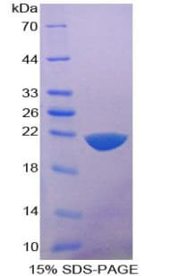 Mouse IL36RN / IL1F5 Protein (Recombinant His-T7)