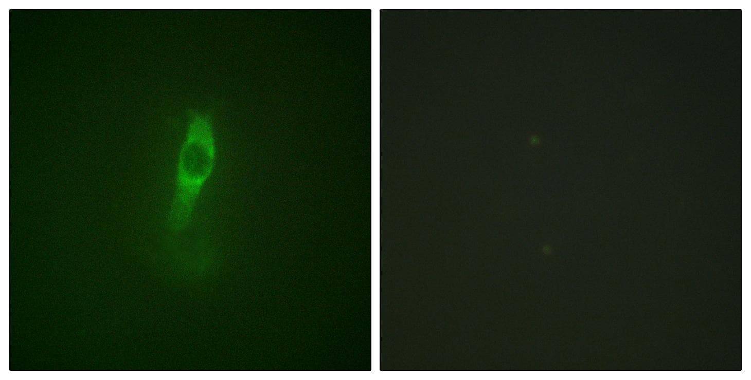 ETK / BMX Antibody (phospho-Tyr40)