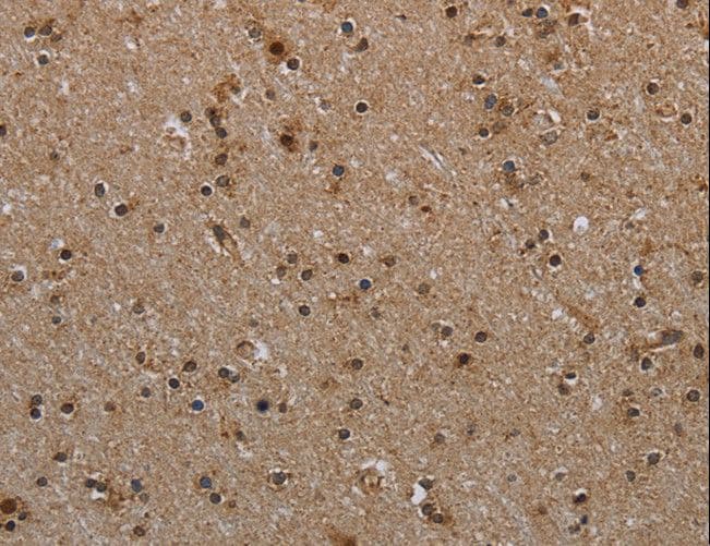 MYO7A / Myosin-VIIa Antibody