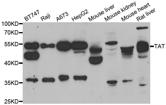 Tyrosine Aminotransferase Antibody