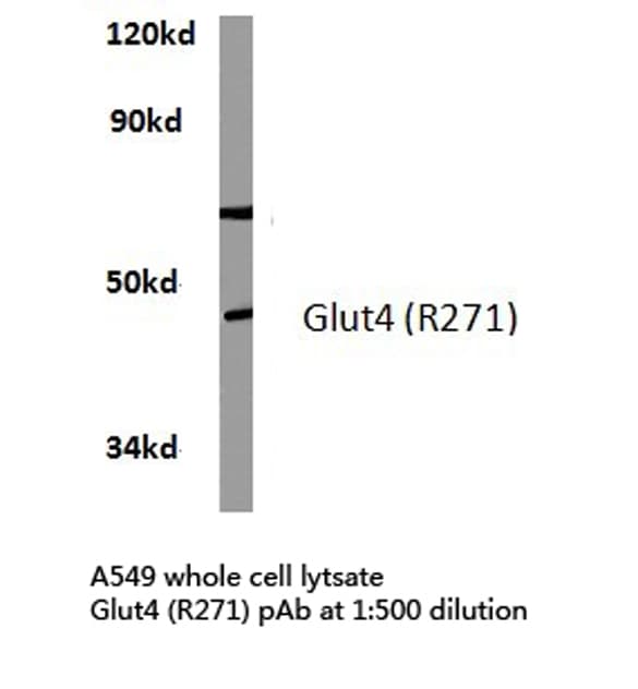 SLC2A4 / GLUT-4 Antibody (Arg271)