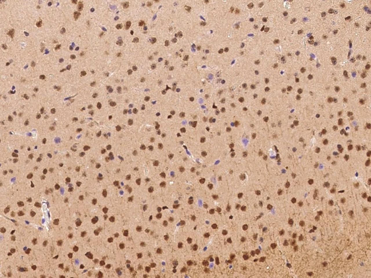 NACC1 / NAC1 Antibody (Preservative Free)