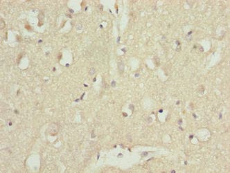 Polyclonal Rabbit anti-Human CDC26 Antibody (IHC)
