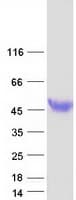 Human HPR Protein (Recombinant Myc-DDK (Flag))