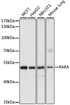 Polyclonal Rabbit anti-Human RARA / RAR Alpha Antibody (IHC, WB)