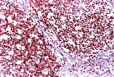 MKI67 / Ki67 Antibody (DY488)