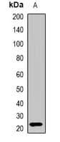 Polyclonal Rabbit anti-Human IL28B Antibody (IHC, WB)