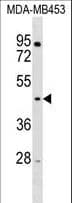 RNF128 / GRAIL Antibody (aa115-143)