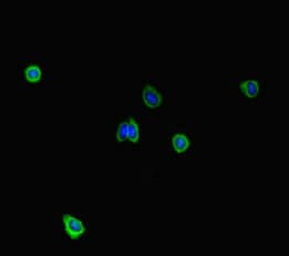 Polyclonal Rabbit anti-Human STIL Antibody (IHC, IF)