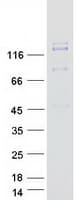 Human c-Met Protein (Recombinant Myc-DDK (Flag))