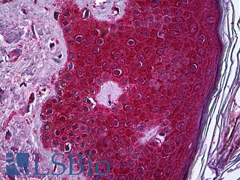IHC-plus™ TNF Alpha Antibody (clone M 1 C4)