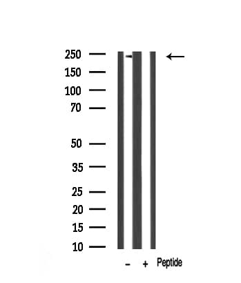 Dysferlin Antibody