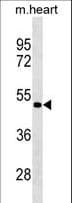 Polyclonal Rabbit anti-Human PCOLCE2 Antibody (aa201-230, WB)