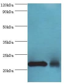 NCS1 / Neuronal Calcium Sensor Antibody (aa1-190)