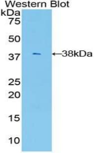 AKT3 Antibody (aa46-338)