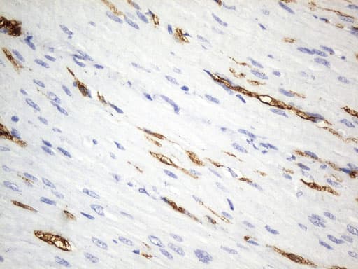 UCHL1 / PGP9.5 Antibody (clone UMAB244)